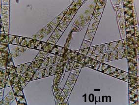 geen algal filaments spirogyra